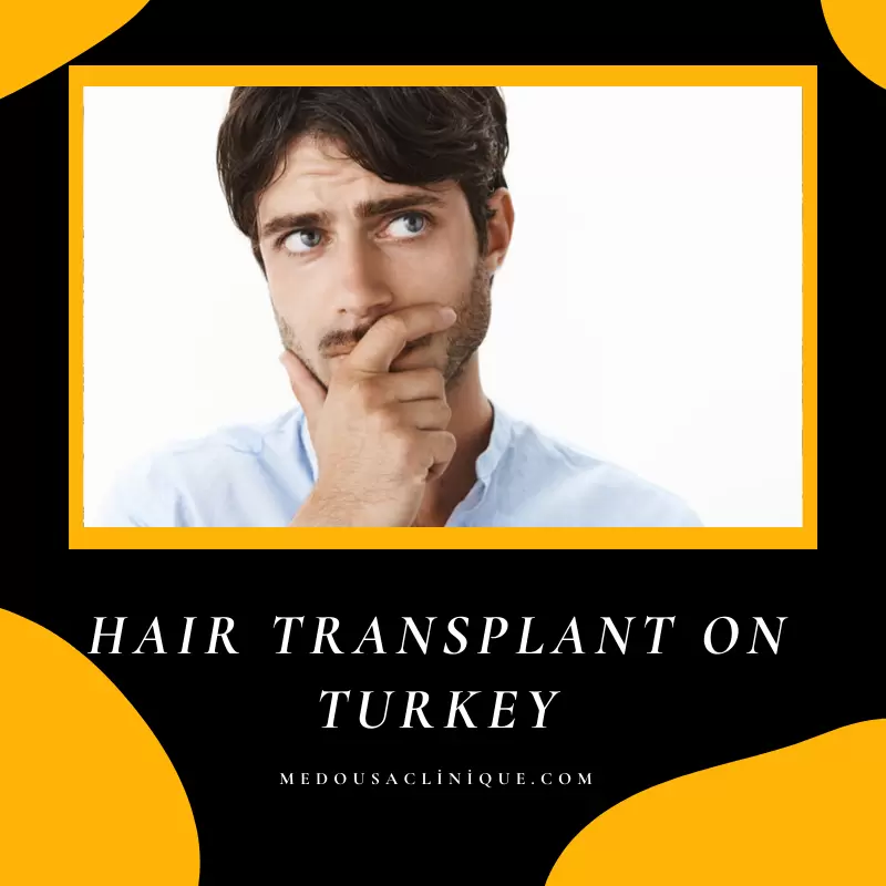 HAIR TRANSPLANT ON TURKEY