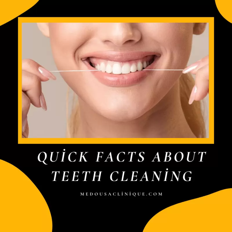 Quick Facts About Teeth Cleaning Medousa Clinique